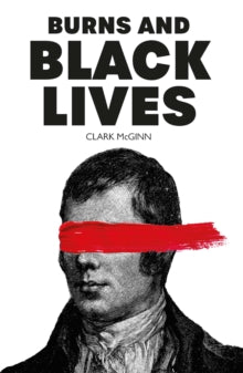 Burns and Black Lives