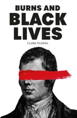 Burns and Black Lives